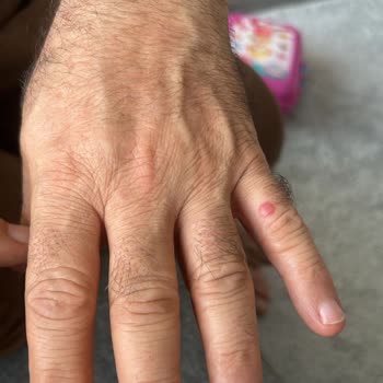 Tahta Kurusu Sorunu Ve İstikbal'den Yetersiz Hizmet