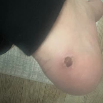 Tommy Hilfiger Botlarıyla Yaşadığım Ağrılı Deneyim