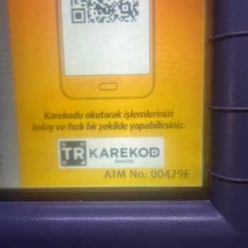 ATM'de Yutulan Para Ve Eksik İade Sorunu