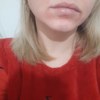 La Roche Posay Ürünleri Cilt Sorunlarına Yol Açtı