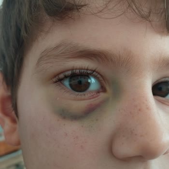 Ebebek Standart Altı Raflar Yüzünden Yaşanan Talihsizlik!