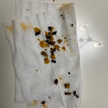 Patos Cips Paketinde Şok Edici Yabancı Madde