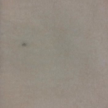 Zara Online Alışverişte Lekeli Ürün Şoku