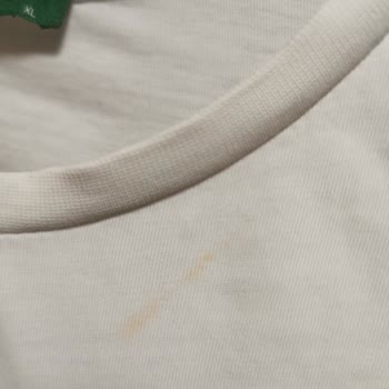 Siemens Çamaşır Makinesi Ve Sarı Leke Sorunu