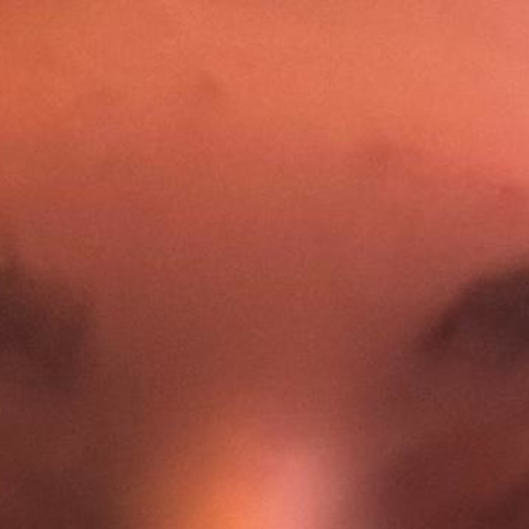 Enda Clinic & Güzellik Merkezi Botox Sonrası Alerji Ve Asimetri Sorunu