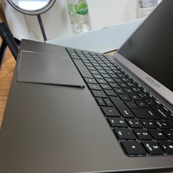 Servis Sonrası Daha Kötü Durumda Gelen Laptop