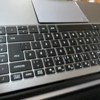 Servis Sonrası Daha Kötü Durumda Gelen Laptop