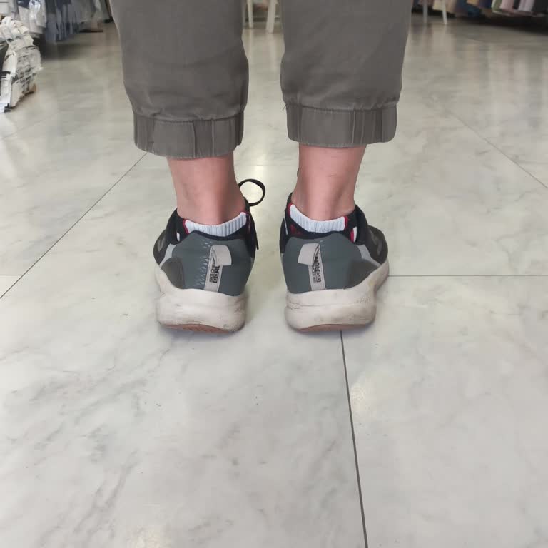 Skechers Ayakkabının Deformasyonu Ayak Sağlığımı Tehdit Ediyor
