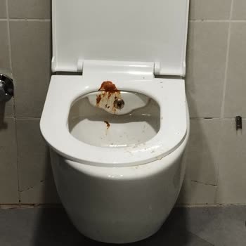 Etlik Şehir Hastanesi'nde Temizlik Sorunu