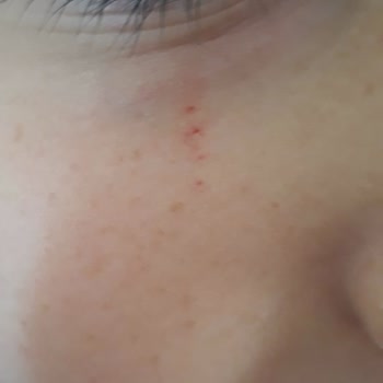 Cumhuriyet İlkokulu (Serik) Çocuğuma Yapılan Şiddete Sessiz Kalınıyor