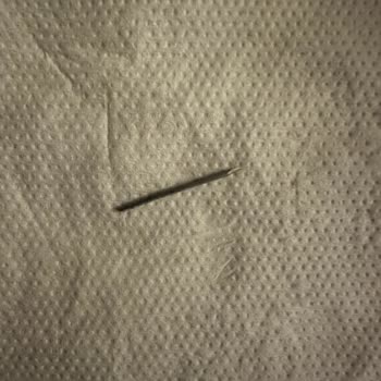 Sucuktan Çıkan Cam Çivisi Şoku