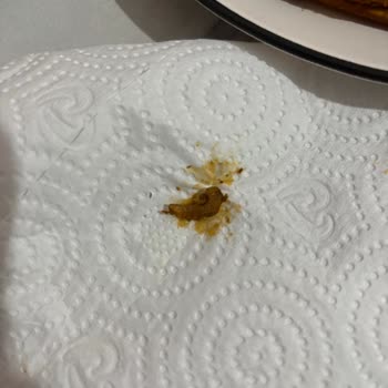 Migros Hemen Siparişimde Solucan Şoku