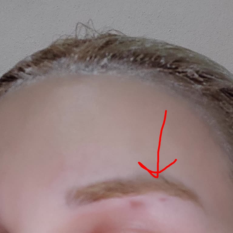 Palette Saç Boyası İle Yaşanan Ciddi Alerjik Reaksiyon