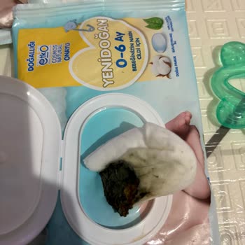 Alerjik Bebek İçin Güvendiğim Markada Küf Şoku