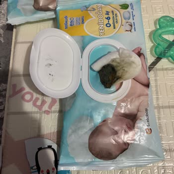 Alerjik Bebek İçin Güvendiğim Markada Küf Şoku