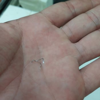 Peynirde Yabancı Madde: Tüketici Sağlığı Tehlikede