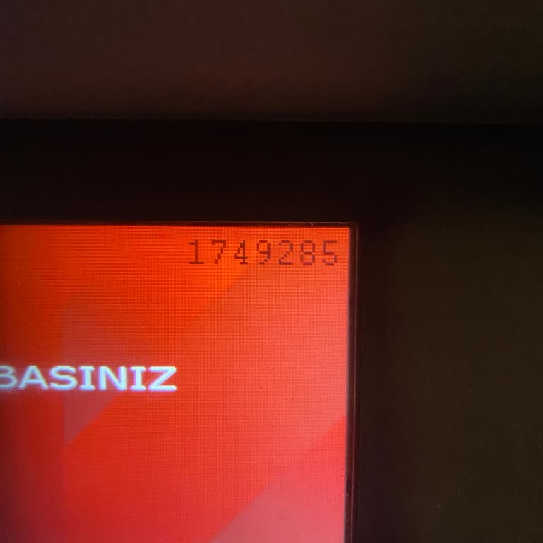 ATM'de Sıkışan Para Ve Eksik Yatırım Sorunu