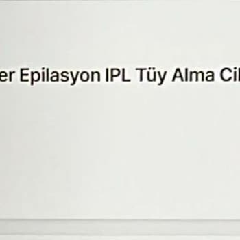 Sepette Fiyat Değişikliği Ve Müşteri Hizmetleri Sorunu