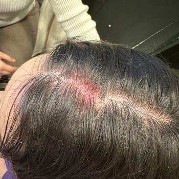 Ankamall AVM'de Güvenlik Zafiyeti Ve İhmalkarlık