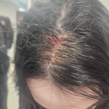 Ankamall AVM'de Güvenlik Zafiyeti Ve İhmalkarlık