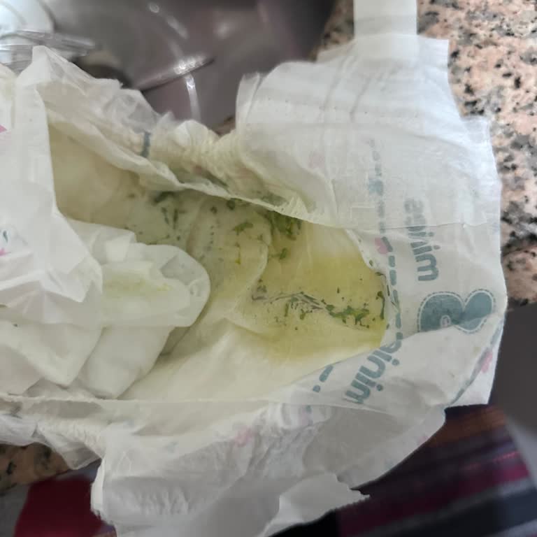 Aptamil 2'nin Sağlık Sorunlarına Yol Açması