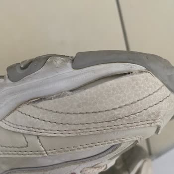 Skechers Ayakkabılarında Sürekli Açılma Sorunu