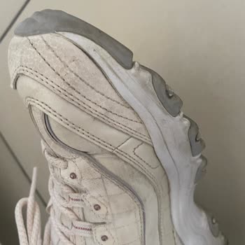 Skechers Ayakkabılarında Sürekli Açılma Sorunu