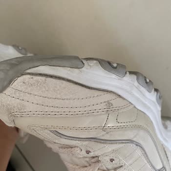 Skechers Ayakkabılarında Sürekli Açılma Sorunu