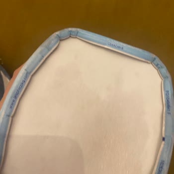 Kusurlu Bebek Maması Ve Yetersiz Müşteri Hizmeti