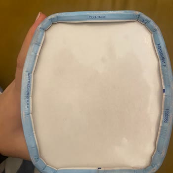 Kusurlu Bebek Maması Ve Yetersiz Müşteri Hizmeti