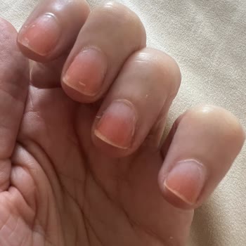 Flormar Oje Tırnaklarımı Mahvetti