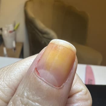 Flormar Oje Tırnaklarımı Mahvetti