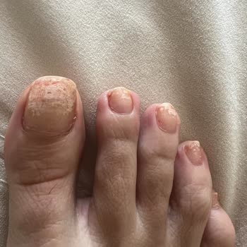 Flormar Oje Tırnaklarımı Mahvetti