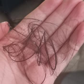 Hcs Kozmetik Saç Dökülmesini Arttıran Ürün Hayal Kırıklığı