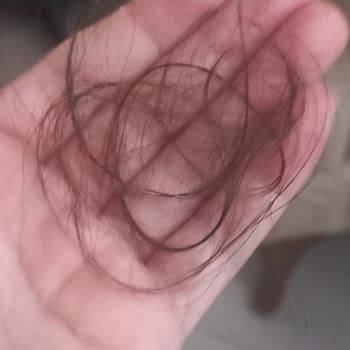 Hcs Kozmetik Saç Dökülmesini Arttıran Ürün Hayal Kırıklığı