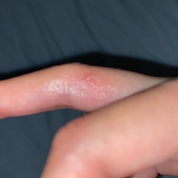 Dyson V10 Kullanımında Parmak Ağrısı Sorunu!