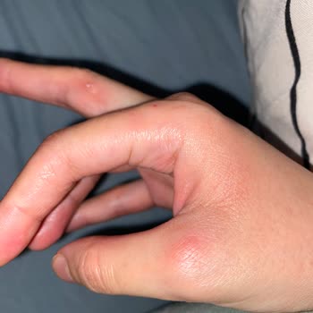 Dyson V10 Kullanımında Parmak Ağrısı Sorunu!