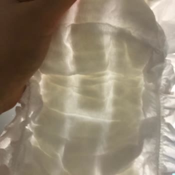 Sleepy Bionatural Bebek Bezi Sızıntı Sorunu Ve İade Zorluğu