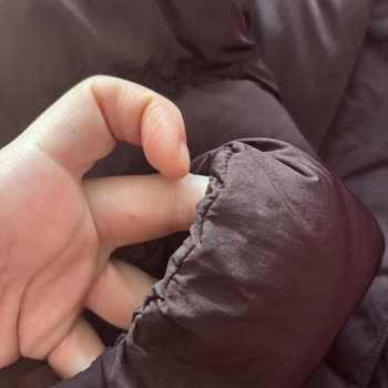 Renk Değiştiren Adidas Mont Ve İade Sorunu