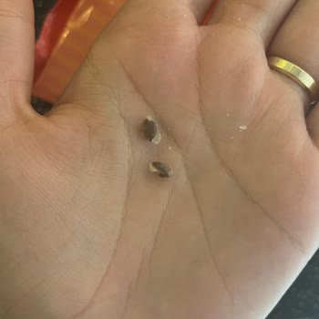 A101 Milföy İçerisinde Şok Edici Bulgu