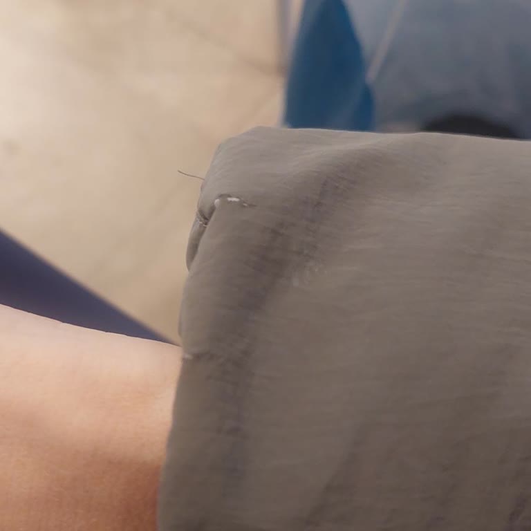 Üründe Bozulma Ve Soyulma Sorunu: Müşteri Hizmetleri Hayal Kırıklığı