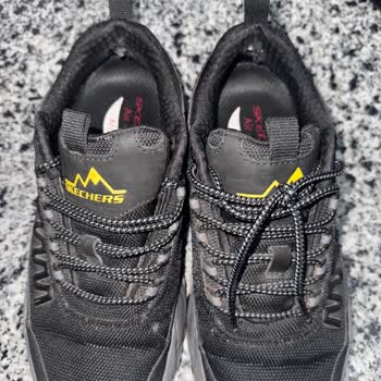 Boyner Ve Skechers'tan İlgisizlik: Deforme Ayakkabı Sorunu Çözülmedi