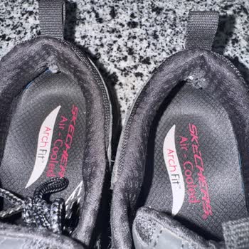 Boyner Ve Skechers'tan İlgisizlik: Deforme Ayakkabı Sorunu Çözülmedi