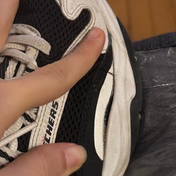 Skechers Ayakkabı Kalitesizliği Ve Müşteri Hizmetleri Sorunu