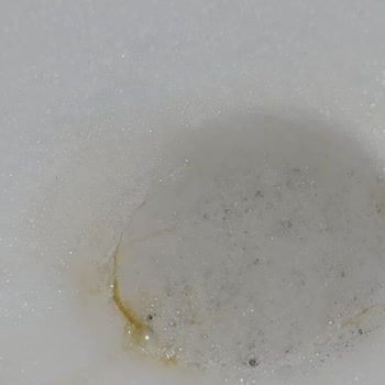 Sarı Su Krizi: Sağlığımız Tehlikede!