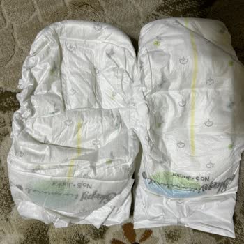 Bebek Bezi Kalite Sorunu Ve Pişik Problemi