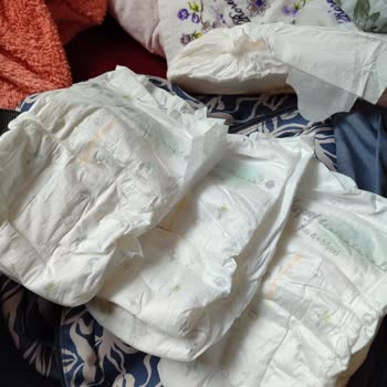 Sleepy Bebek Bezi Kalitesizliği Ve Pişik Sorunu