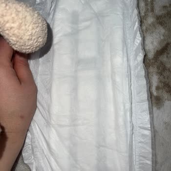 Sleepy Bebek Bezinde Sızıntı Sorunu