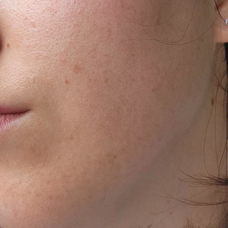 Yves Rocher Ürünleri Cildimde Alerji Yaptı!