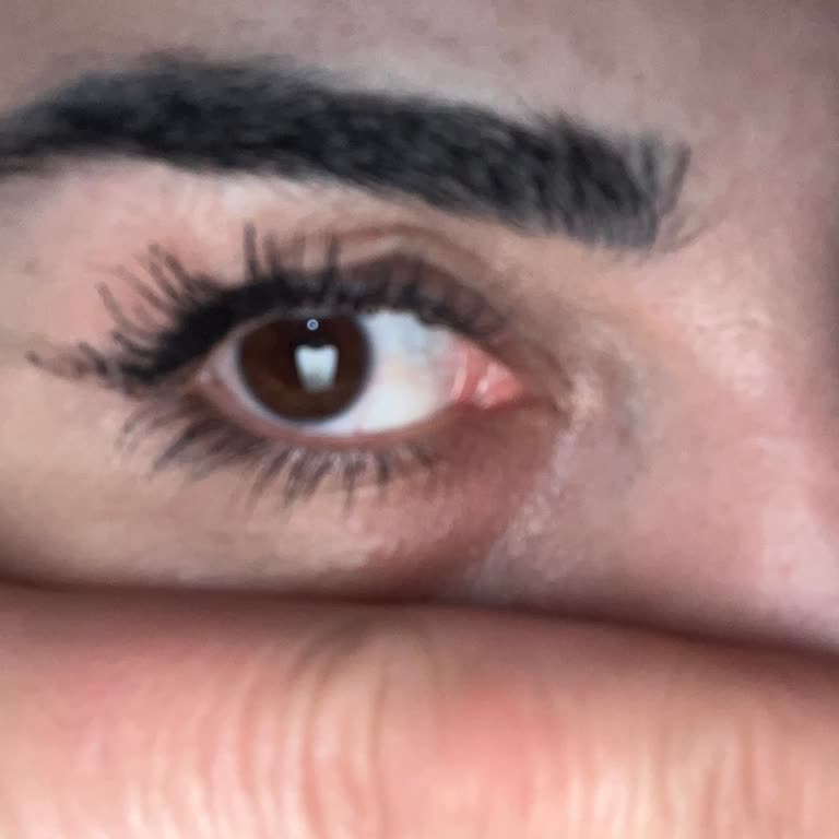 Estetik Operasyon Sonrası Hayal Kırıklığı